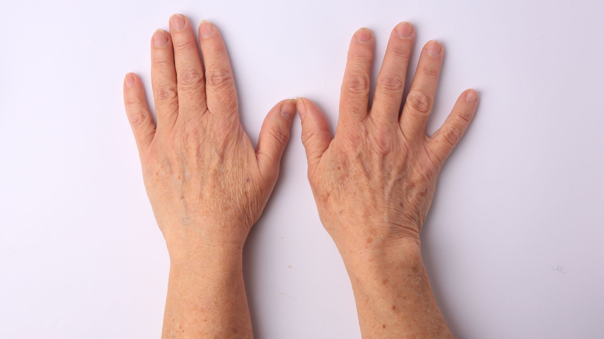 ACS SKINEEDLER- COU - JOUES - MAINS image